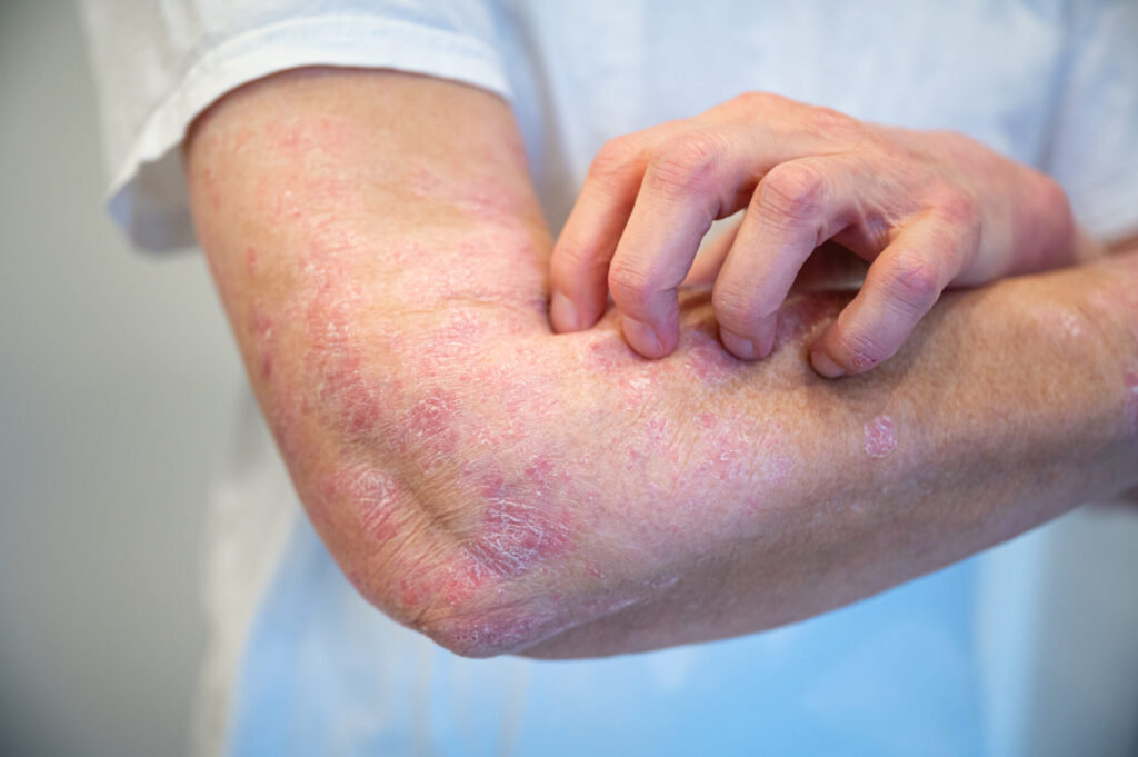 Destiny Health and Wellness | Holistic Allergy Management